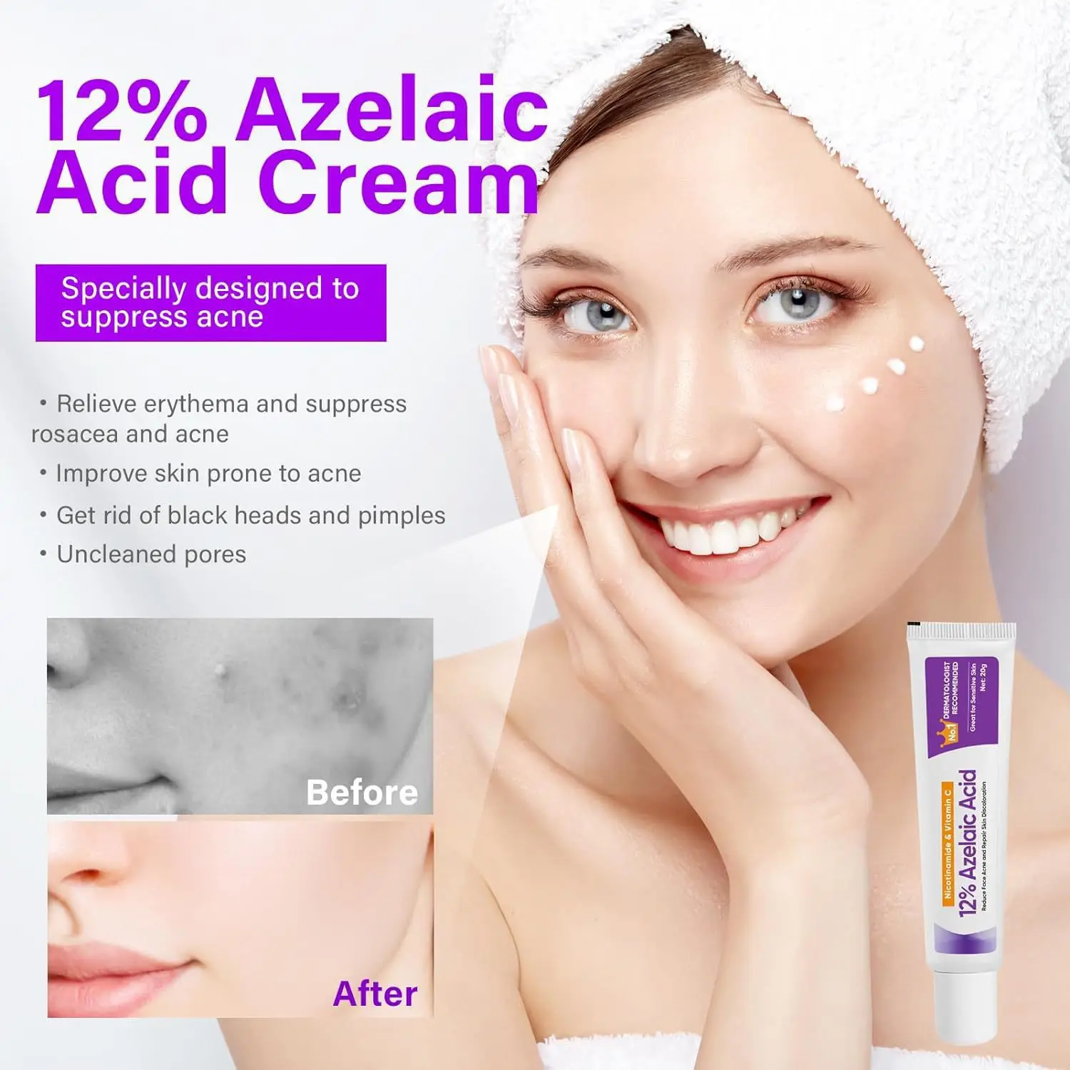 OEM Azelaic Acid Soothing and Acne Removing Ointment Lightening Acne Marks Soothing and Moisturizing Acne Repair face cream