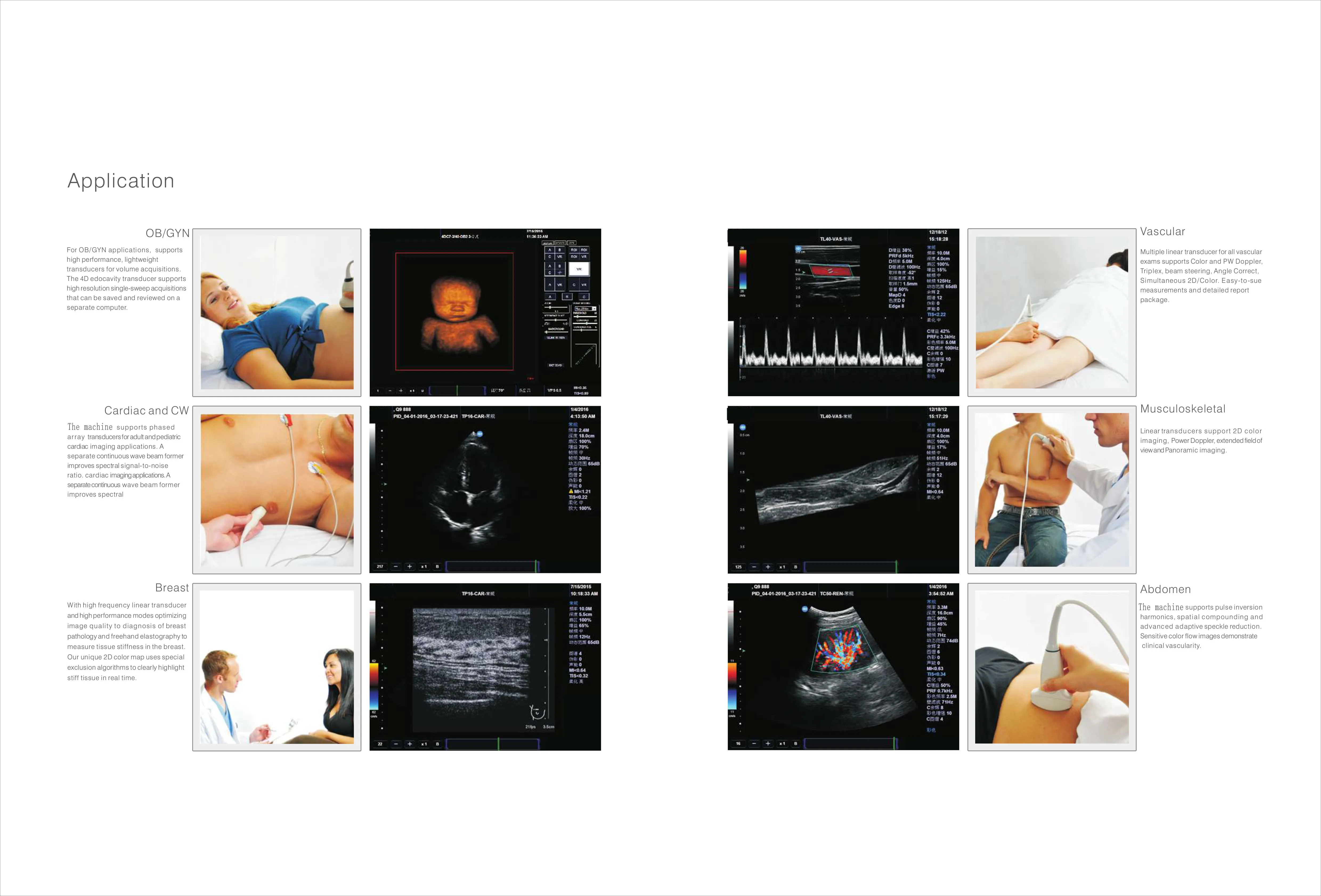 Медицинский ультразвуковой аппарат больничный Цветной Допплер диагностический 3D 4D тележка