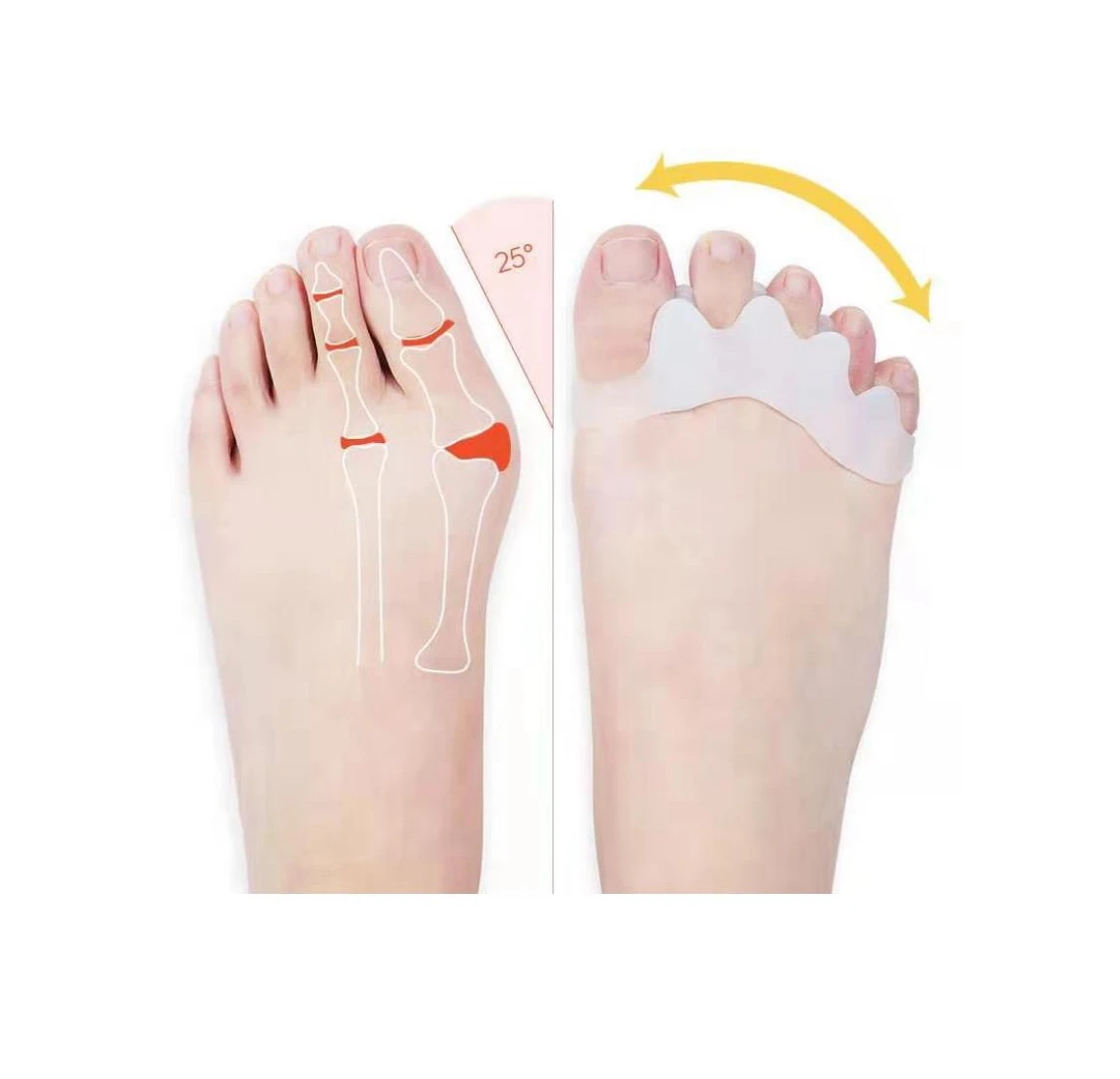 Silicone toe separator toe spacers bunion corrector