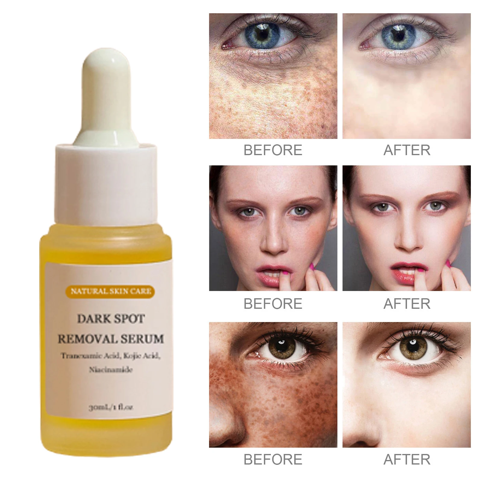 Корейская Органическая гиперпигментация 5% кожевой кислоты Ниацинамид транексамовой для коррекции темных пятен Сыворотка лица