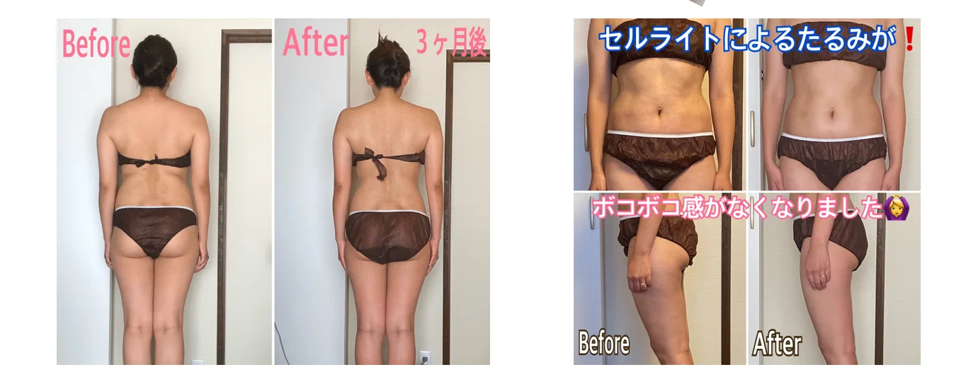 
Home easy use no side effects body fat burn cream stomach slimming 