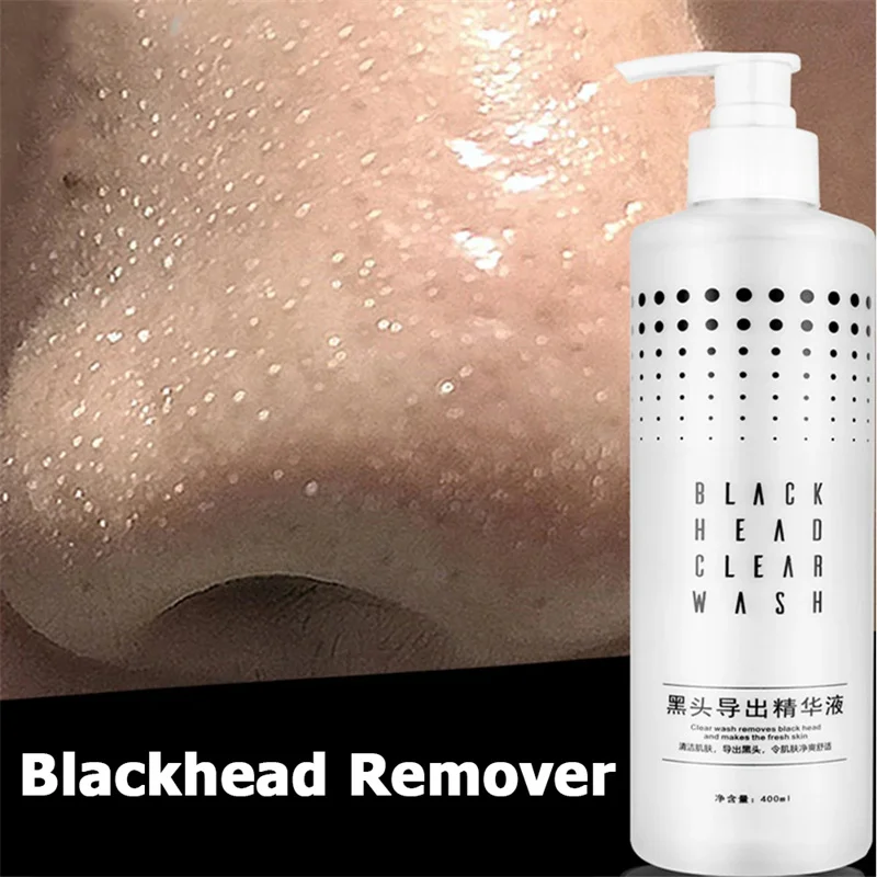 ZS 400ml blackhead extractor liquid deep cleansing oil control shrink pores fruit acid T-zone blackhead export liquid toner