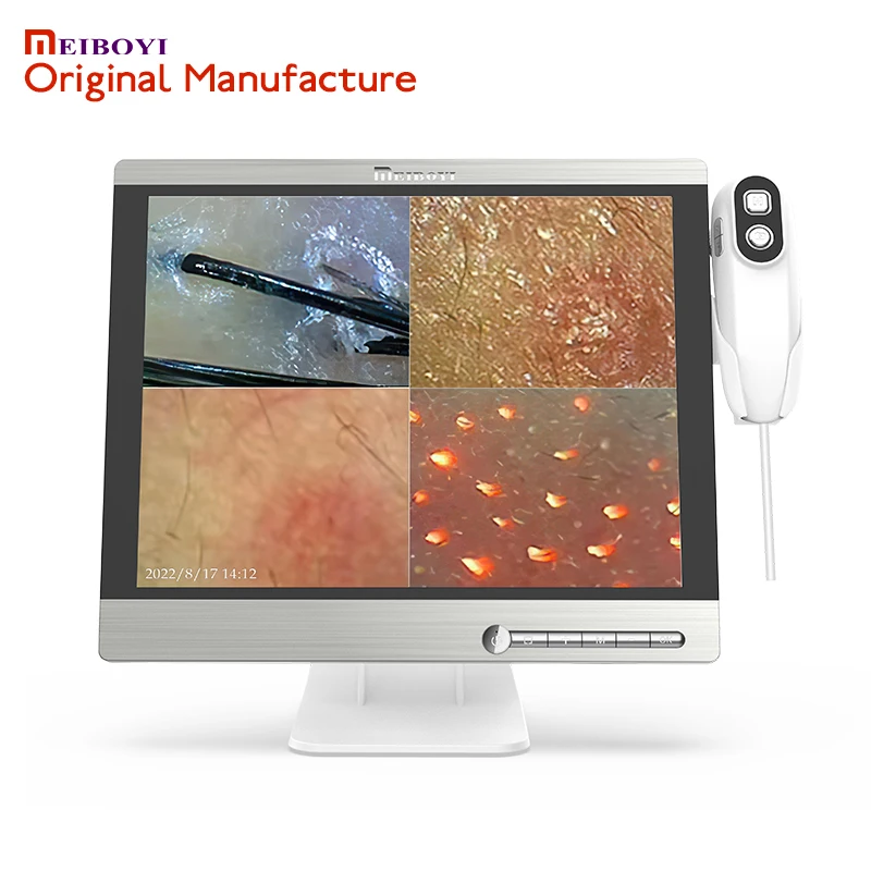 Meiboyi High Quality Handheld Multi-languages HD Scalp Analysis Machine Hair Analyzer for Analyze Scalp Problems