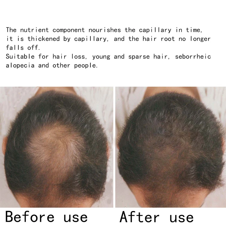 Ginger Germinal Oil