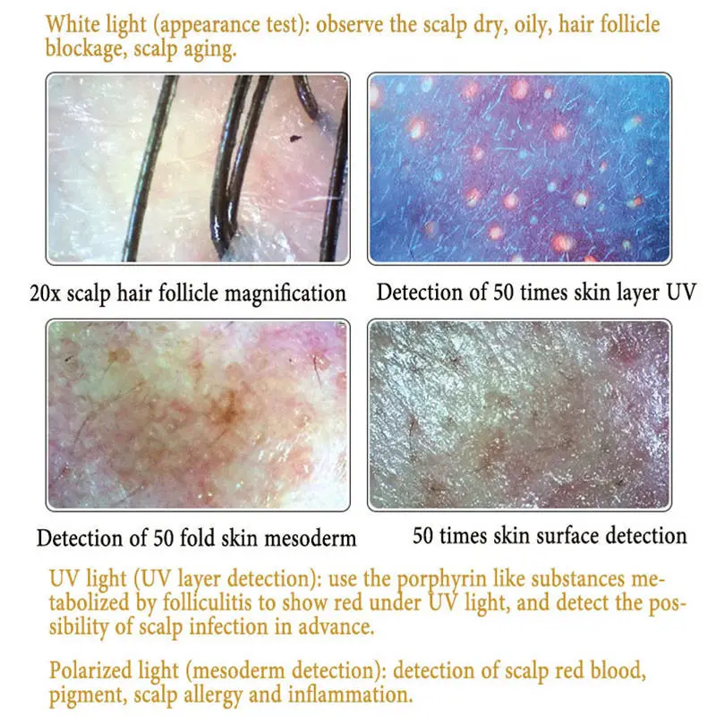 Meiboyi Skin Analysis Machine Scalp Camera by Simple operation of four-spectrum scalp skin detector analyzer For Beauty Home