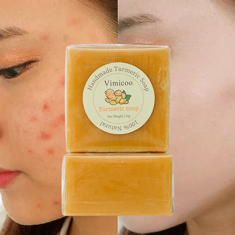 Natural Herbal Private label Skin Care Anti Acne Vegan Organic Face Cleaning Body Bath Tumeric Turmeric Handmade Bar Soap