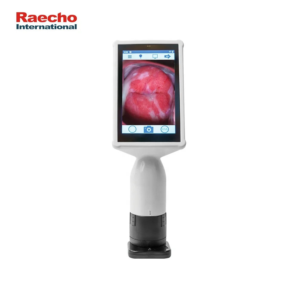 Digital Colposcope Handheld Colposcope Camera for Gynecology