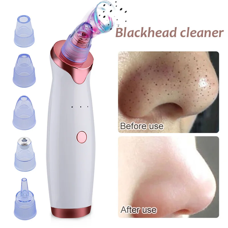 2020 Best Selling 5 In 1 Facial Pore Deep Cleaning Electric Blackhead Remover Vacuum Pore Vacuum Cleaner