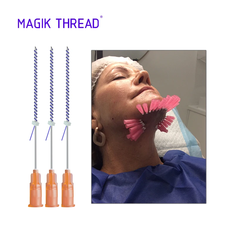  Magik Thread tornado screw pdo 27 г 38 мм подтяжка кожи лица лифтинг Стерильная Двойная резьба