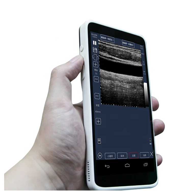 Healson Medical Ultrasound Machine With Color Doppler Usg