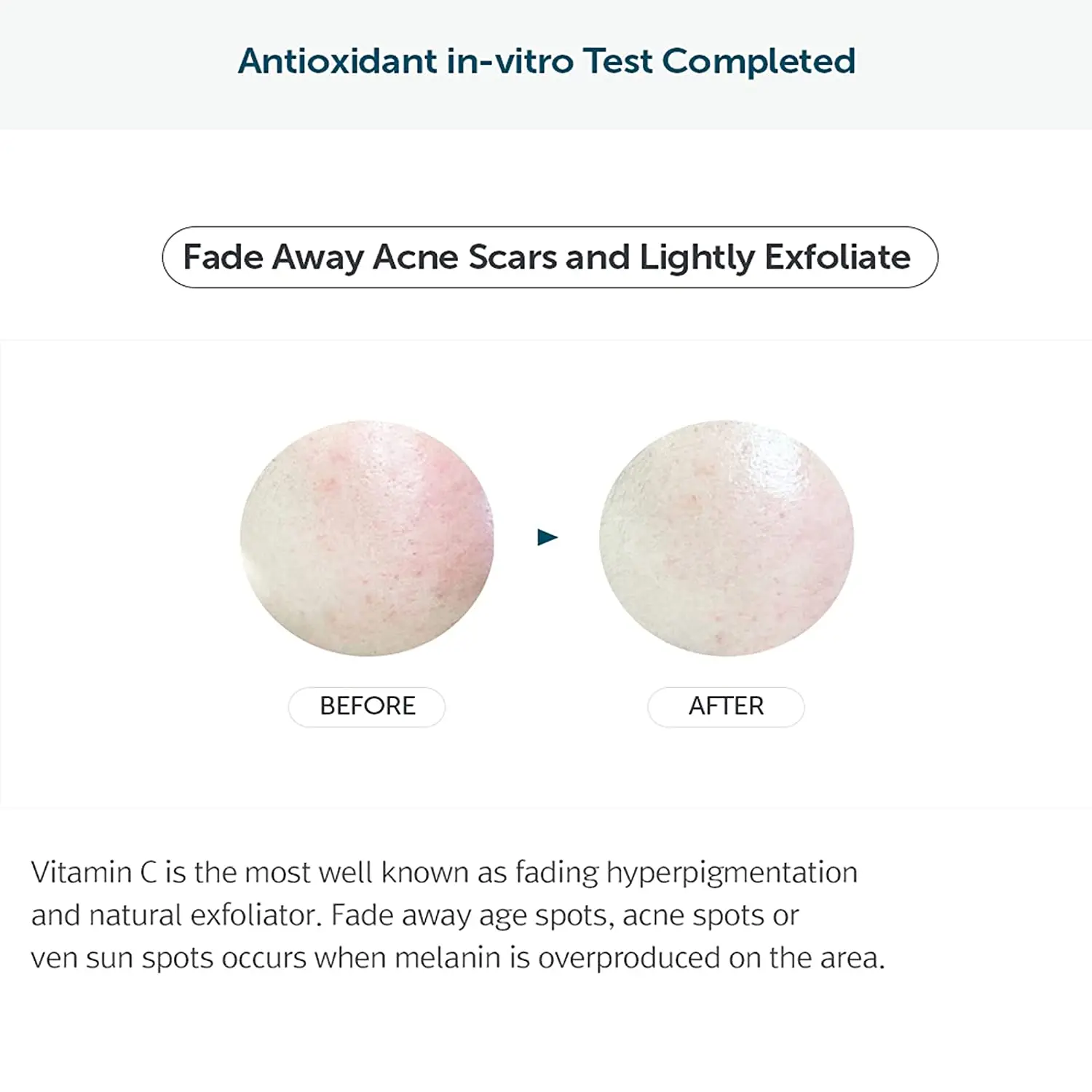 Private Label OEM Moisturizing Anti-wrinkle Hydrating Juiced Vitamin Drop with 5% Hypoallergenic pure vitamin C serum