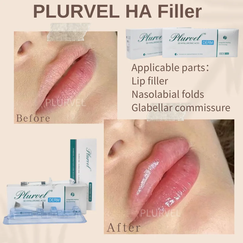 PLURVEL Hot Sale DERM 1ml Hot Sale Neuramis Deep Filler Facial Injection Dermal Filler Ha