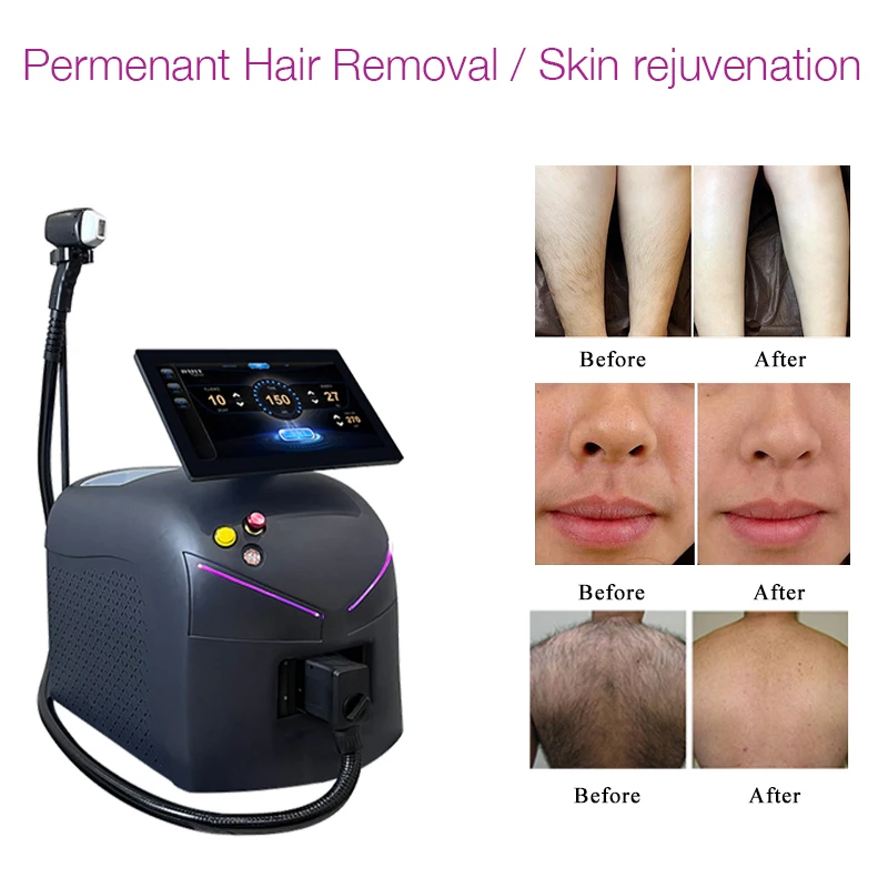 PREDATOR X3+ diode laser 1600w price 1064nm 940nm  808nm 755 nm diode laser hair removal hair removal laser