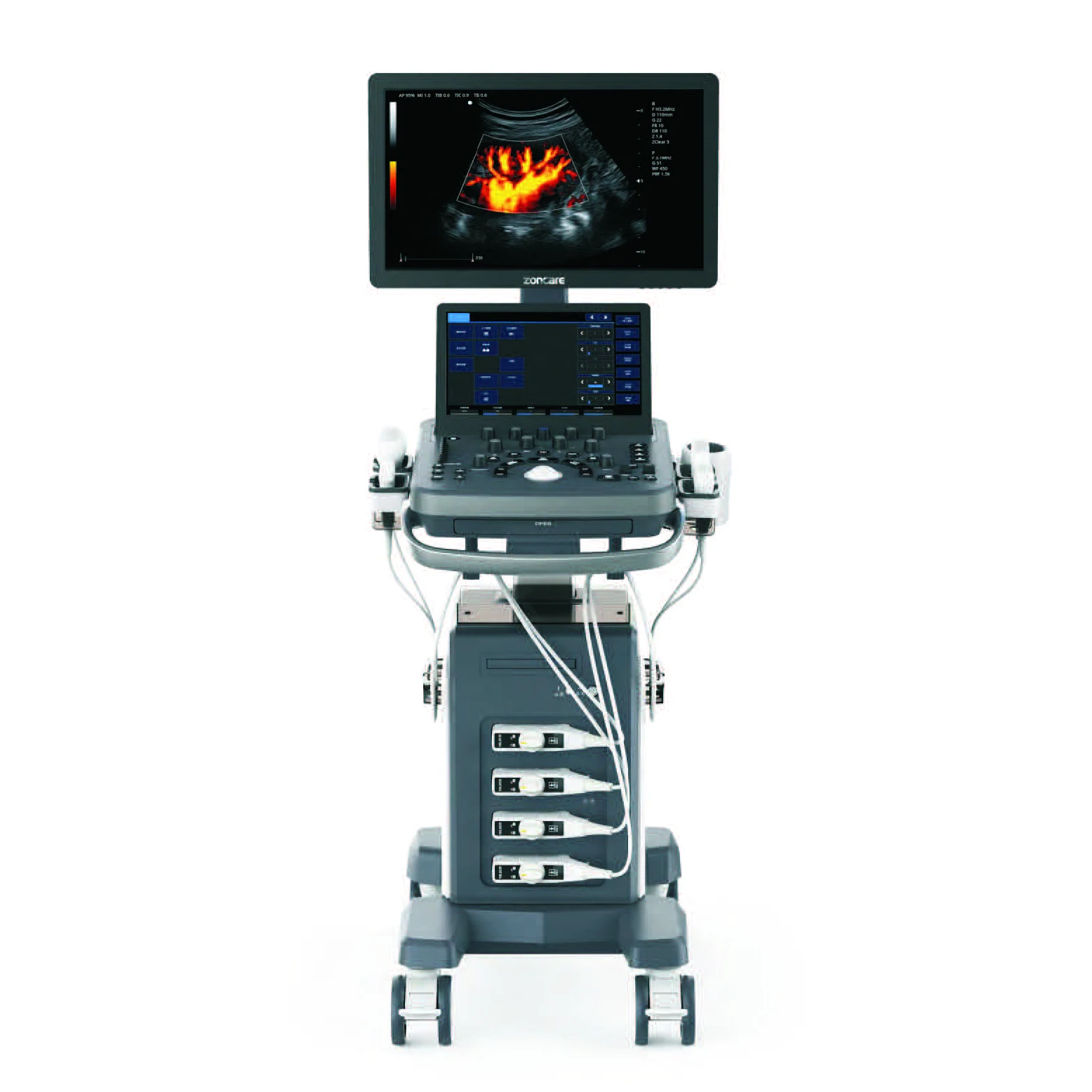 OPENO 520 Trolley Color Doppler Ultrasonic diagnostic 3D/4D ultrasound scanner