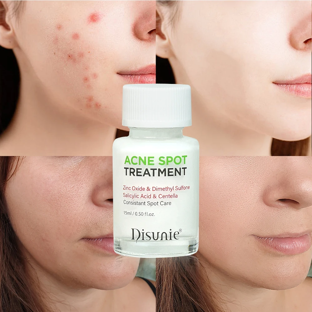 Disunie Acne Spot Treatment With Centella Asiatica Facial Pore Deep Cleansing Acne Scar Removal Exfoliating Serum
