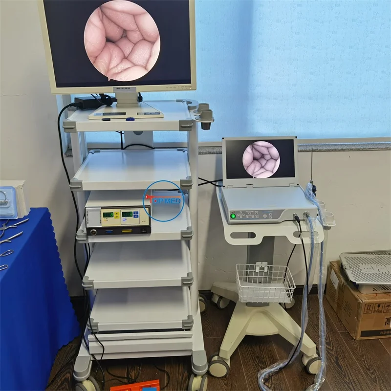 FHD Endoscopy Camera HD Unit Portable endoscope camera system for Laparoscopy Hysteroscopy Urology ENT Arthroscopy