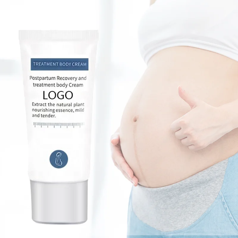 OEM лучший Органический крем для Удаления растяжек и шрамов