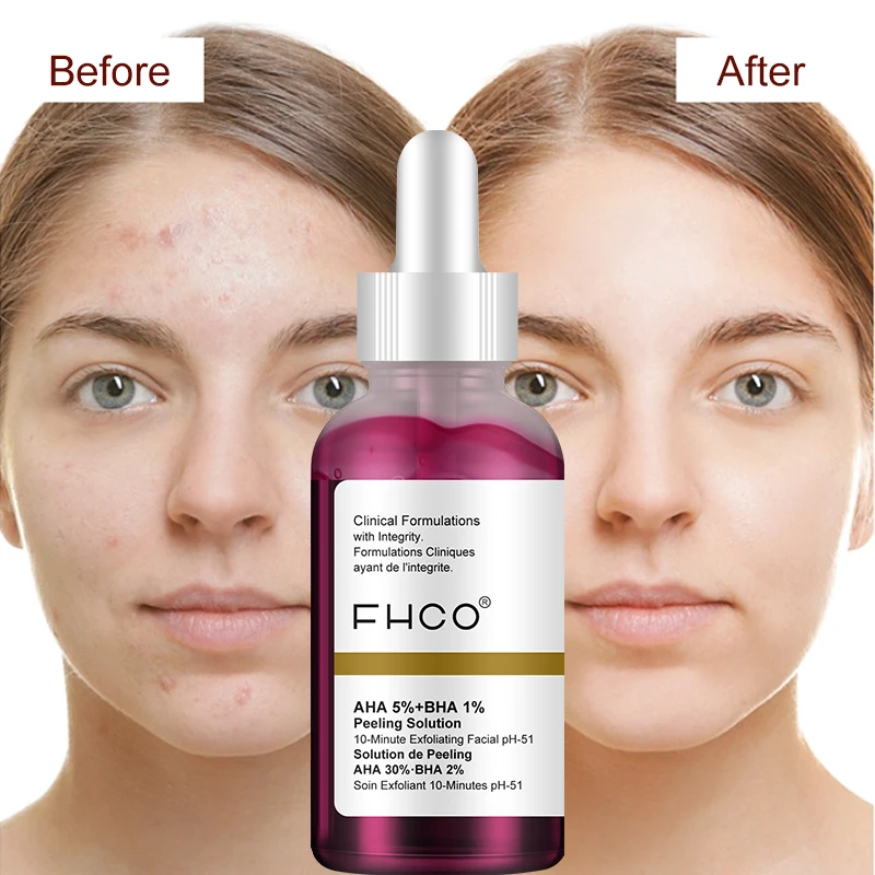 Custom Private Label Acid Anti Acne Treatment Skin Care Whitening Moisturizing Brightening Oil Control Salicylic Acid Acne Serum