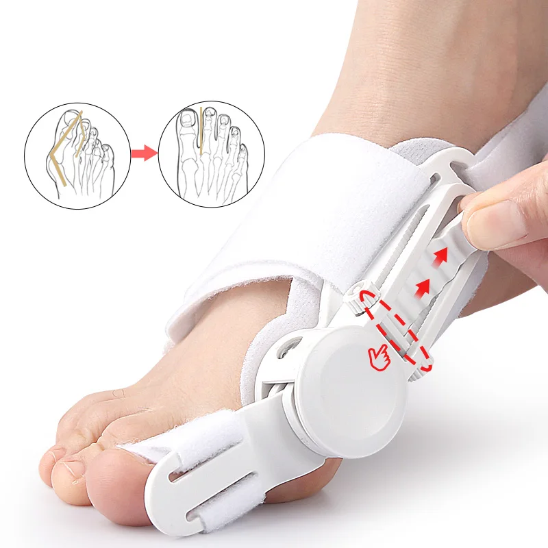 Thumb eversion orthosis with protruding foot bones, overlapping toe separator knob buckle, adjustable orthosis