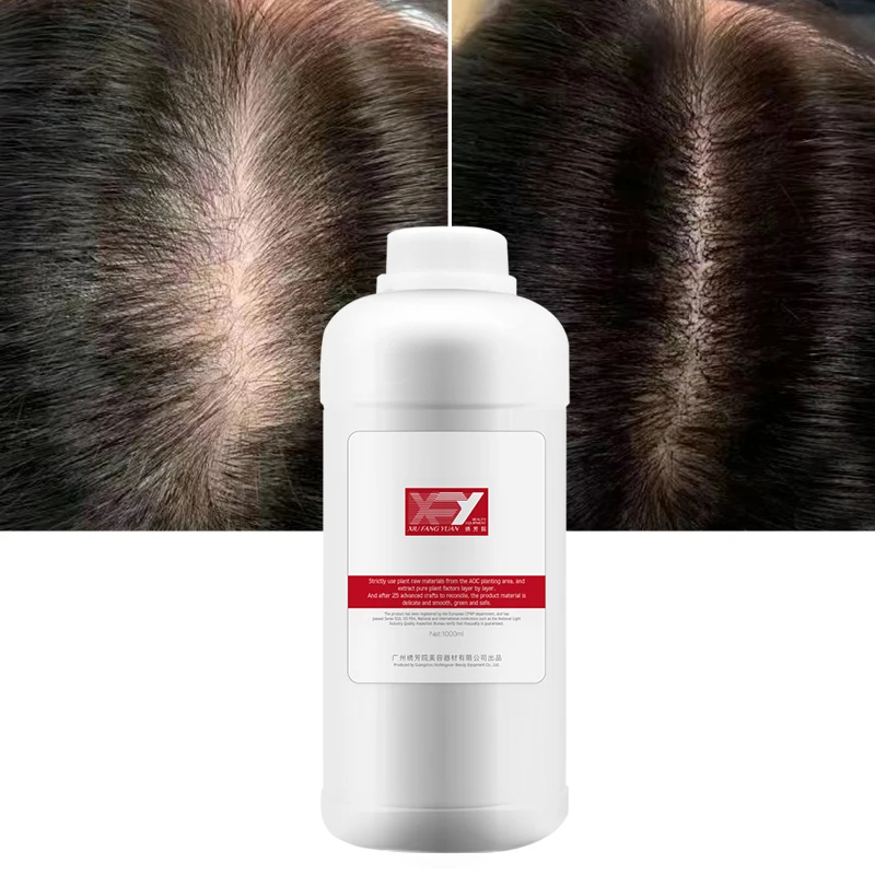 1 литр Уход за волосами Лечение рост волос масляный агент предотвращает выпадение волос питательная сыворотка роста