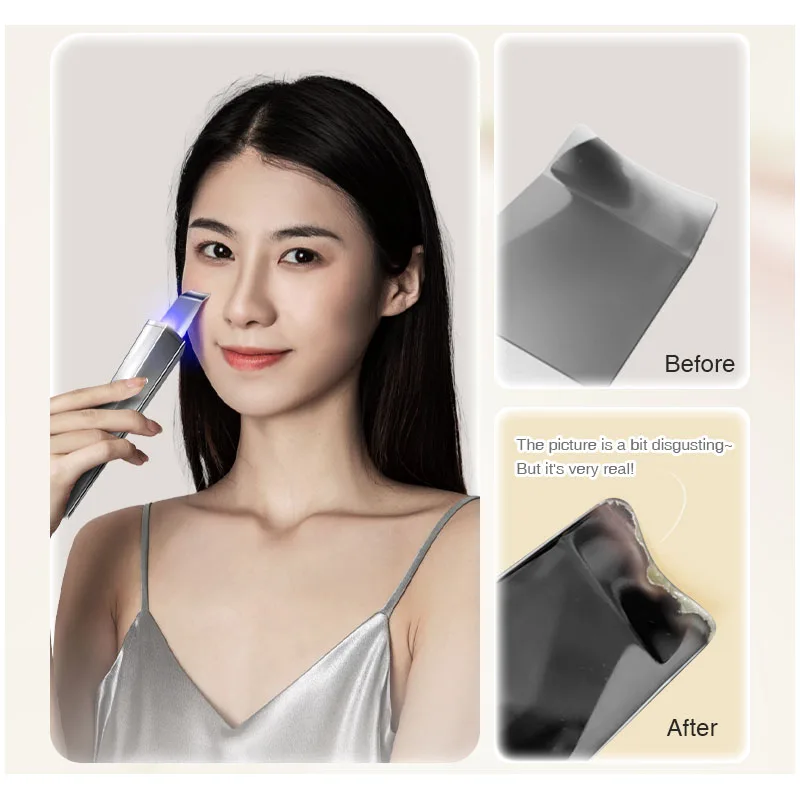 Professional Portable Electric Sonic Face Cleaning Spatula Ultrasonic Skin Scrubber Beauty New Model Dead Skin Peeling Machine