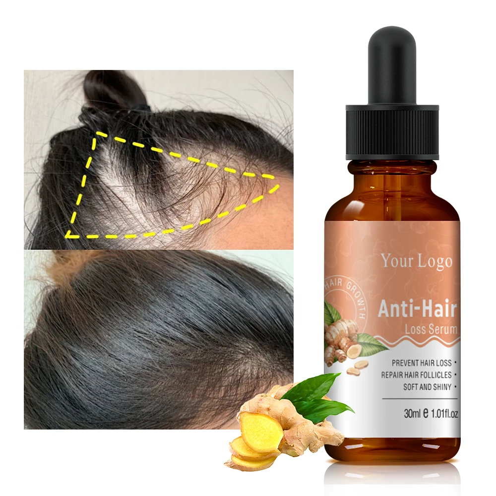 OEM Natural Organic Ginger Oil Hair Growth Treatment Anti Loss Hair Growth Serum for anti hair fall