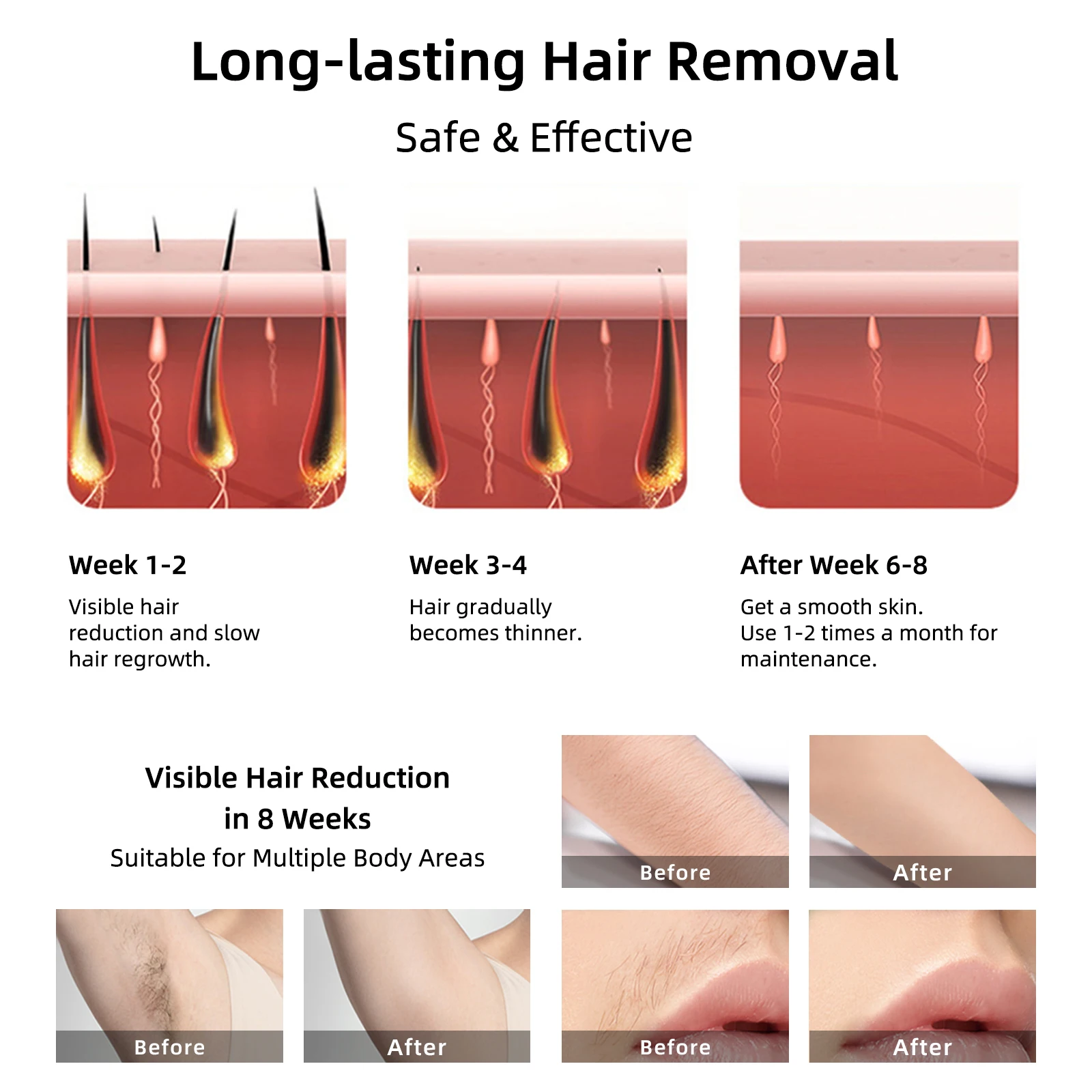 510K IPL Hair Removal Painless at Home Laser Hair Removal Device for Face Armpits Legs Bikini Line