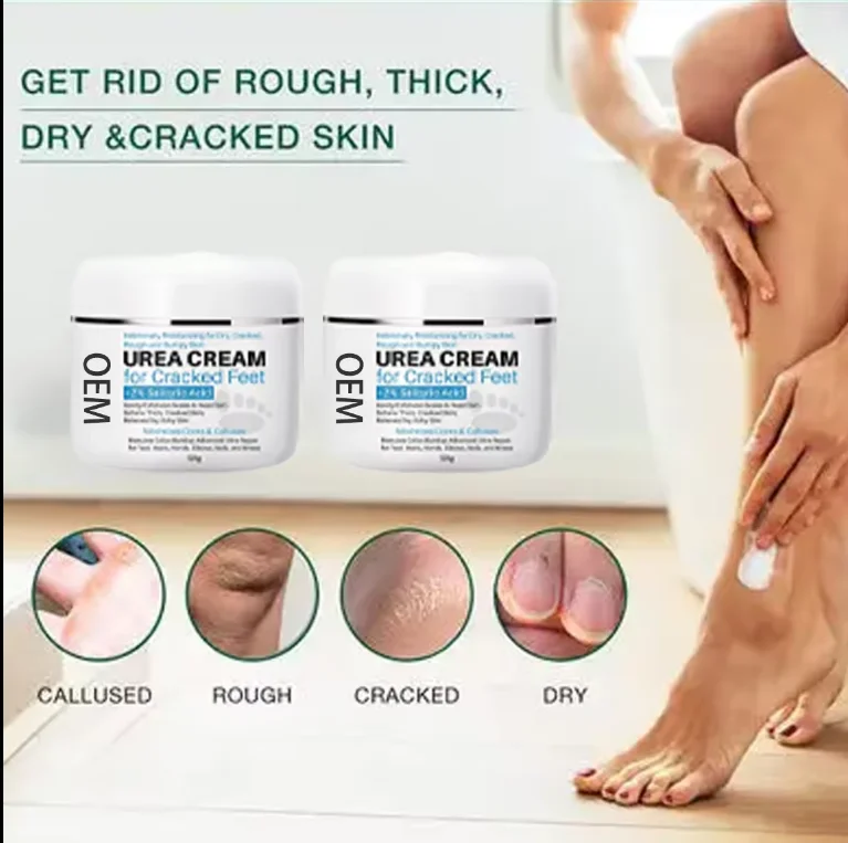 2% salicylic Acid Dead skin removal exfoliating treatment for cracked heels urea 40% foot cream hand and foot cream
