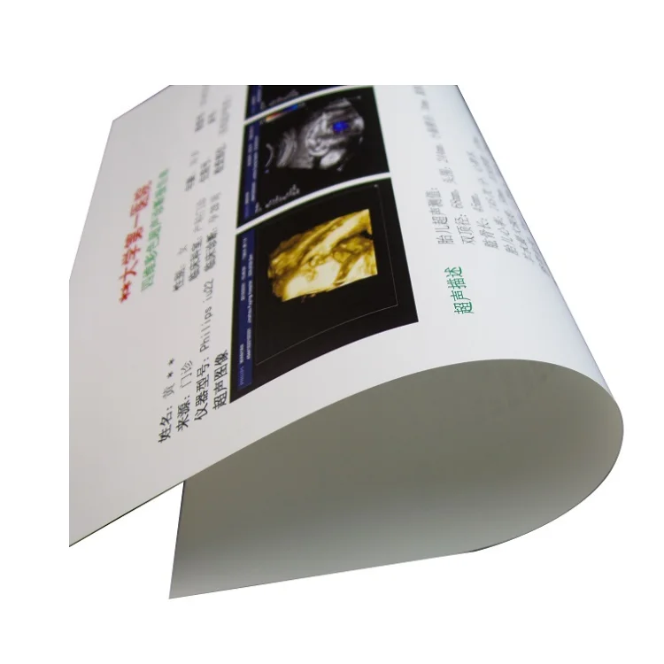 
B Ultrasonic / Colour Doppler Ultrasonic Endoscope / 3D-reconstruction Image CR DR CT MR film 