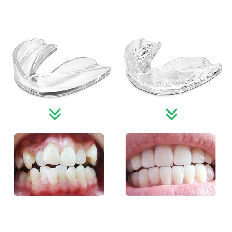 Orthodontics Invisible Dental Retainer Tray Training Mouth Guard