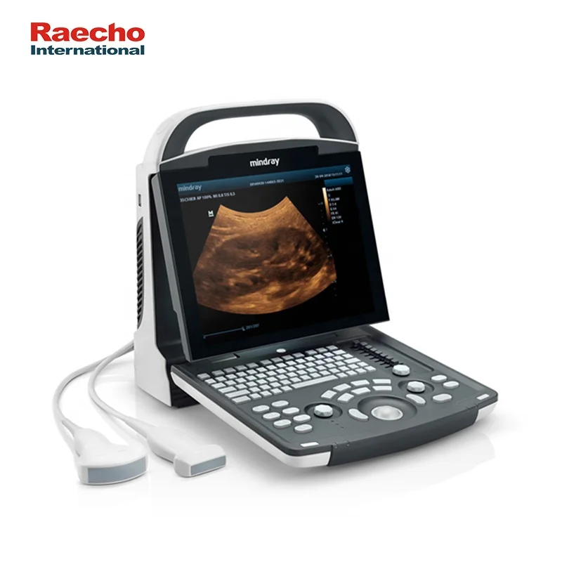 Mindray DP-10 B/W Ultrasound Machine Laptop Ultrasound Scanner Machine for Human