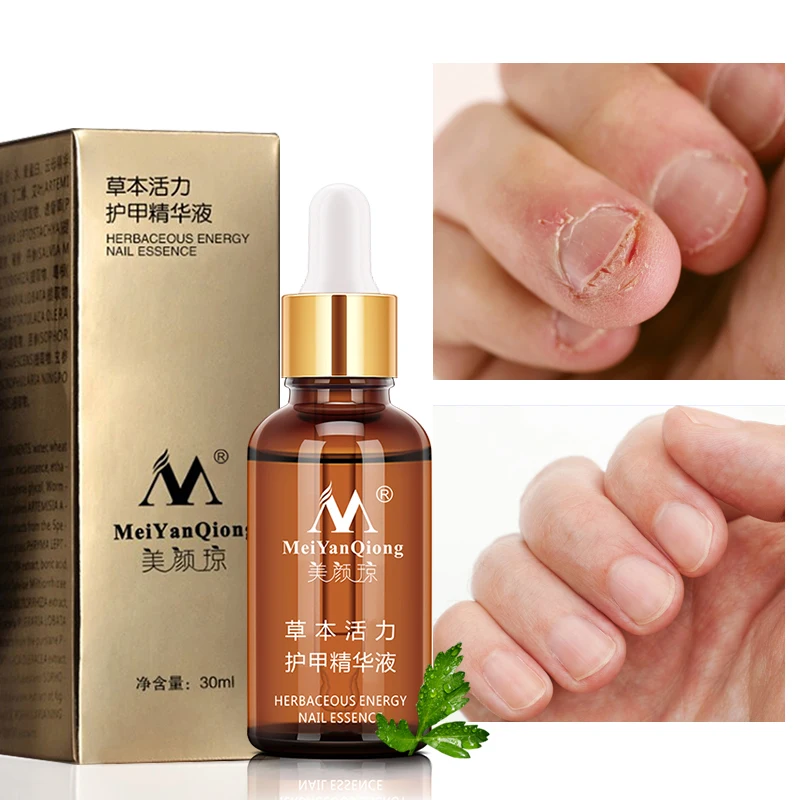 
Natural Nail Care Nourishing Growthl Cuticle Oil Nail Essential Oil With Dropper Bottle 