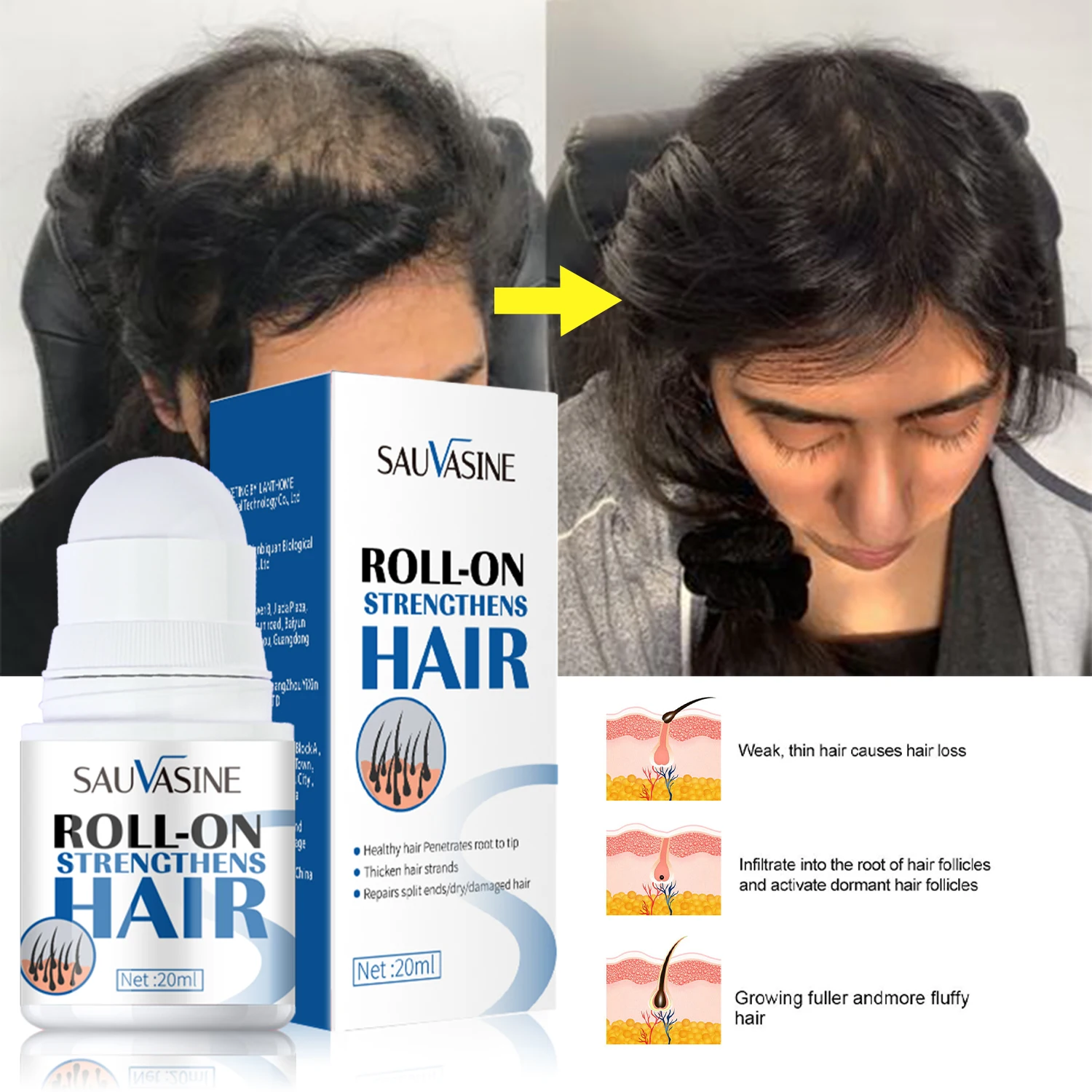 OEM Hair Growth Oil Hair Loss Treatment Repair Split Dry Damaged Roll On Strengthens Hair