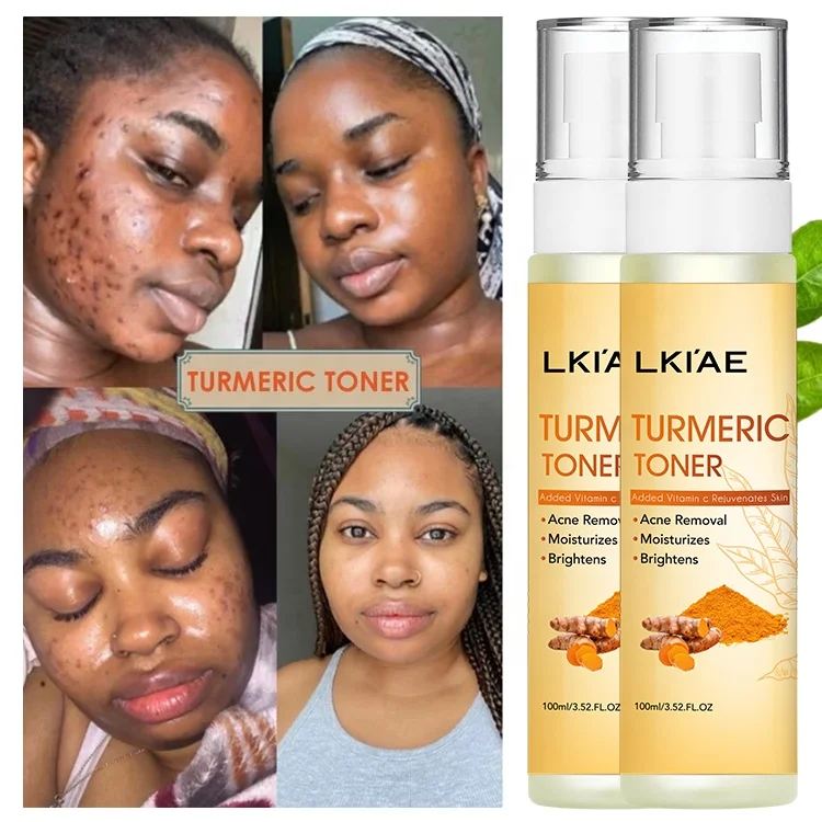 Хит продаж увлажняющая вода для лица натуральный отбеливающий очищающий ластик темное пятно куркума Осветляющий Тонер кожи