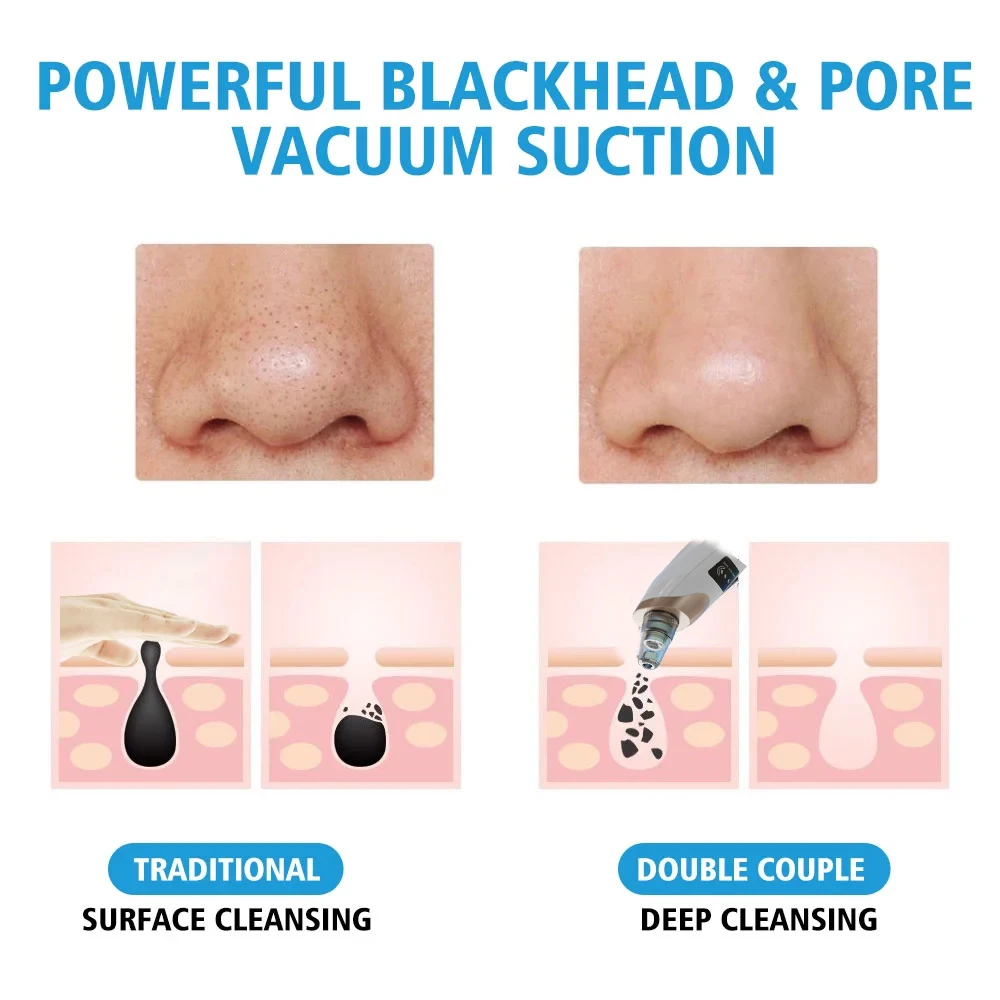 Pore Cleaner Blackhead Remover Vacuum Face Skin Care Suction Black Head Black Dots Blackheads Pimples Removal Deep Cleaning Tool