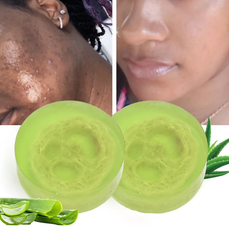 Private label organic vegan natural essential oil base loofah soap bar anti acne skin whitening handmade toilet aloe vera soap