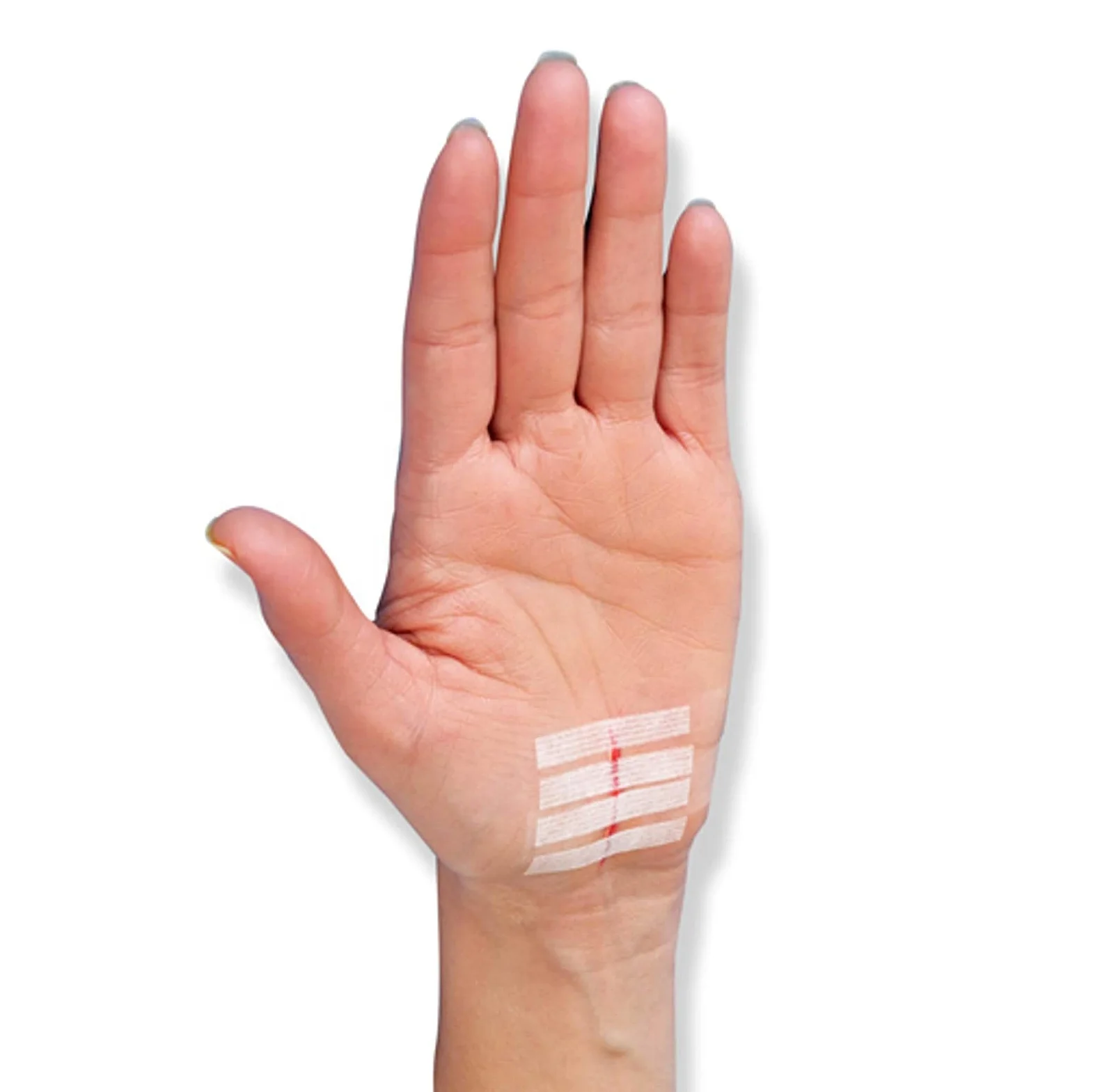 
 Медицинская клейкая застежка для раны для хирургии и косметической раны послеоперационный уход хирургическая одноразовая повязка  