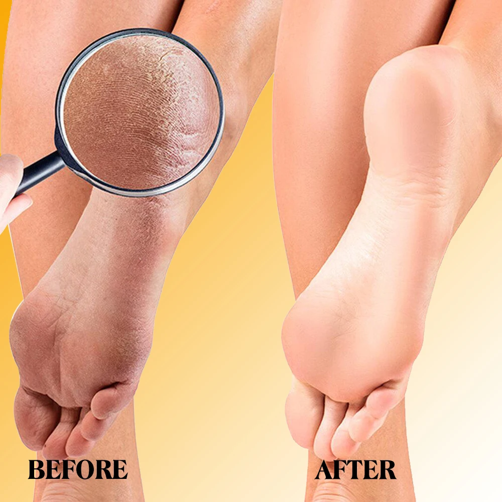 Private Label Dear She Whitening Organic Honey Essence Foot Heel Cream Moisturizing Softens Calluses Repairing Nourishing Skin