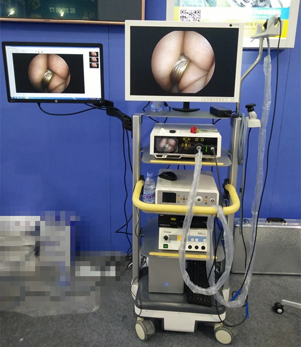 2.7mm 4mm arthroscopy surgery tower endoscope camera with arthroscopy shaver