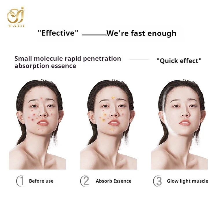 China custom private label Mint panthenol Azelaic acid Remover Blackhead anti-acne beauty serum face kit home lady