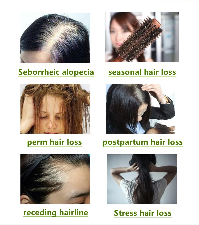 Luxurious high quality anti-dandruff oil control anti hair loss natural herbal shampoo