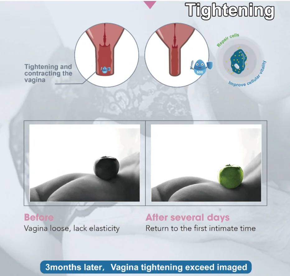 3g 5g 20g China Exclusive Enzyme Formula Vaginal Tighten Gel For Detox Whitening