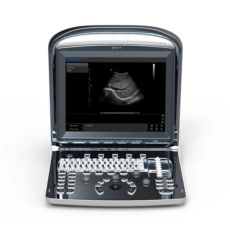 Самый дешевый портативный ультразвуковой аппарат Chison Eco1 Ultrasonido B/2B/4B/M 3D 4D с
