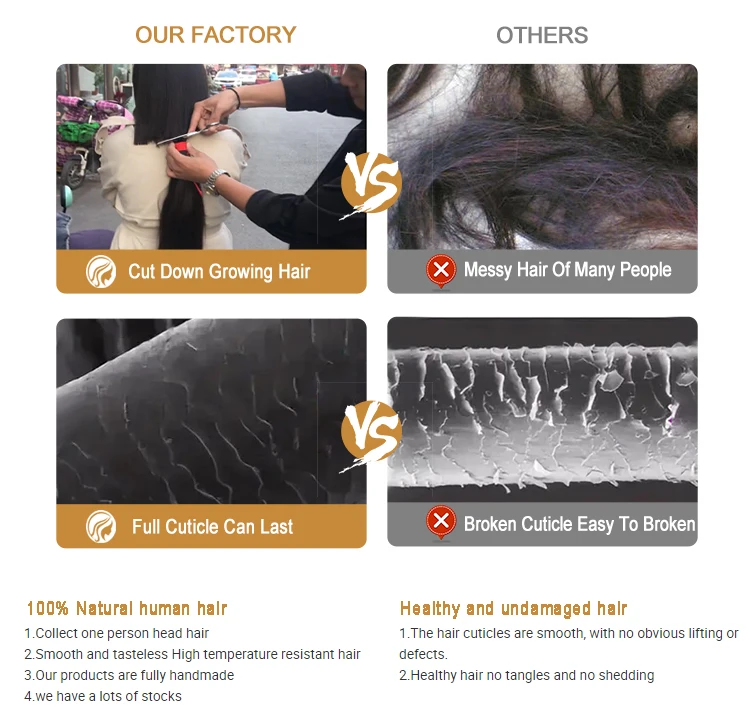 Glueless Silk Top Silicone Medical Wig Replacement European Human Hair For Alopecia Or Cancer Medical Prothesis Wig For Women