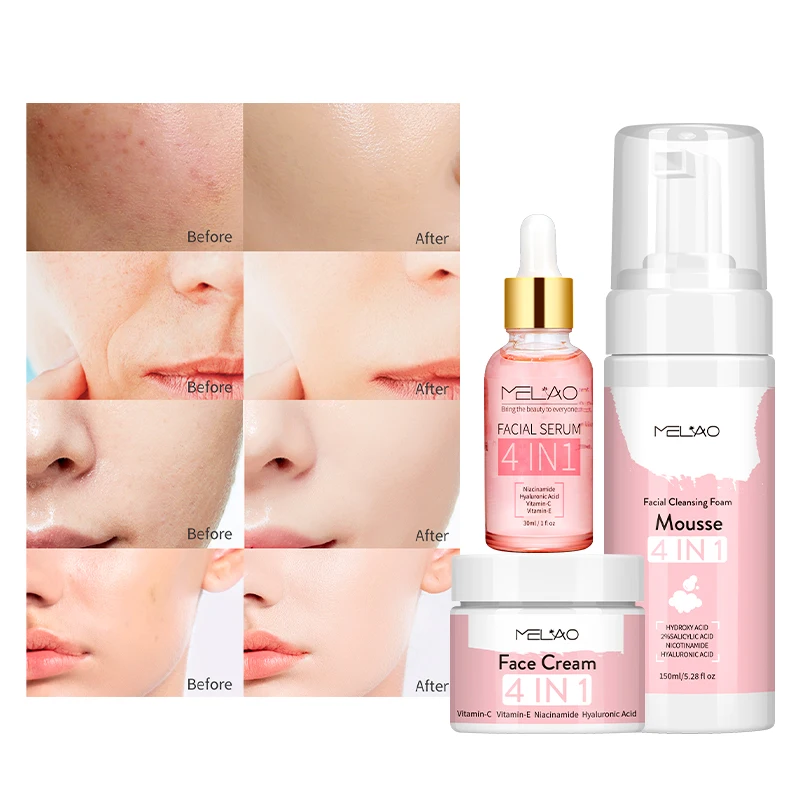 Hot selling Private label Natural organic Acne Remover Deep Cleansing Anti Aging White Lightening 4-in-1 face care set