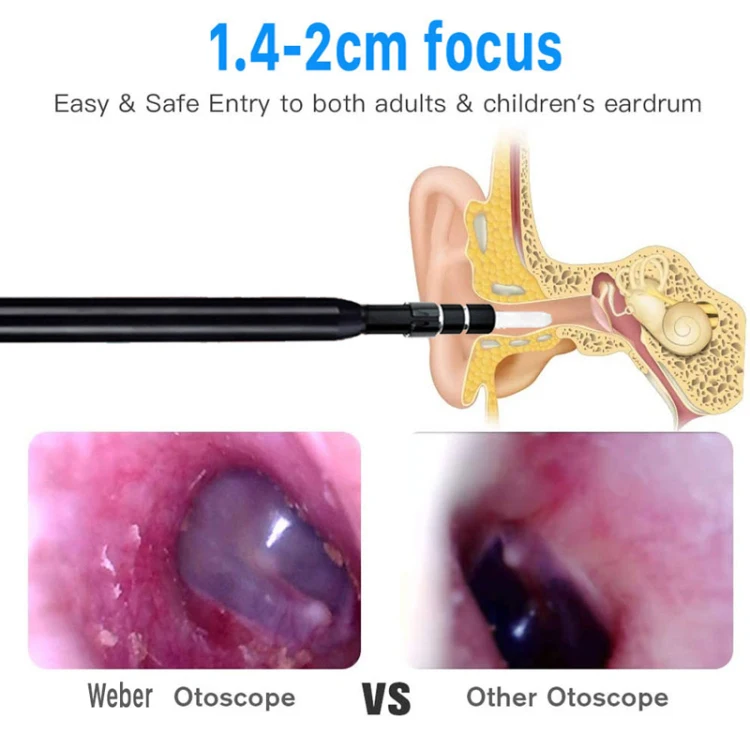 720P HD multifucnction 5.5mm ear nose inspection pen otoscope 3in1 USB ear endoscope for home and doctor care