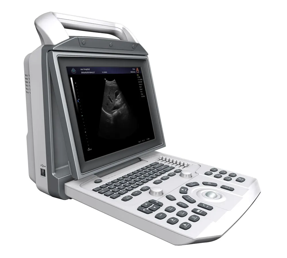 Factory Price B&W Ultrasound Portable Black and White Ultrasound MSLPU46