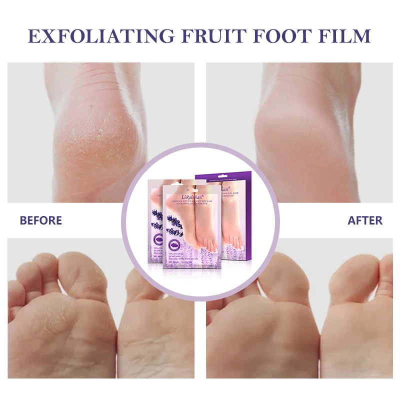 
Amazon OEM Supplier Baby SKIN CARE Feet Exfoliating Spa Socks Foot Peel Mask foot exfoliation peeling mask 