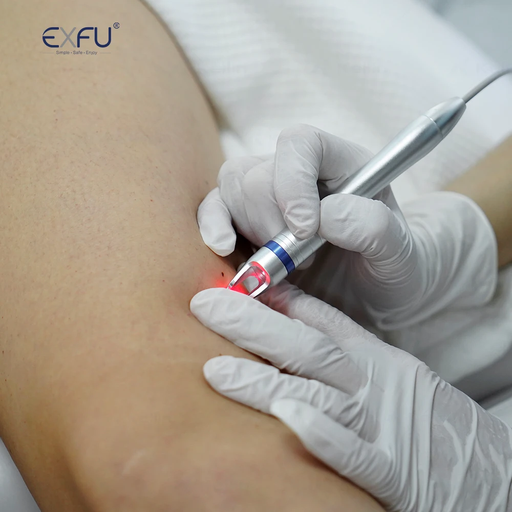 EXFU 4IN1 Multiple beauty instrument ipl skin rejuvenation nd yag laser prezzi delle machine diode Laser Hair Removal 808Nm