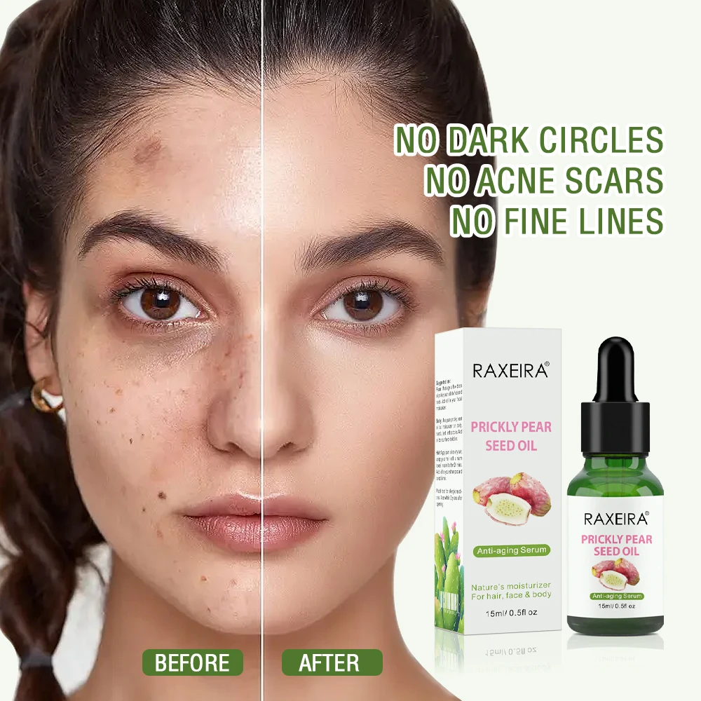 Organic 100% Pure Prickly Pear Seed Oil For Face Dry Skin And Body Moisturizer And Hair Treatment